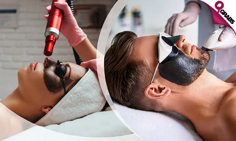 Flawless Skin with Carbon Laser Peel for Ladies & Men!